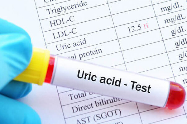 Định Nghĩa Acid Uric là gì? Tìm hiểu về chỉ số Acid Uric